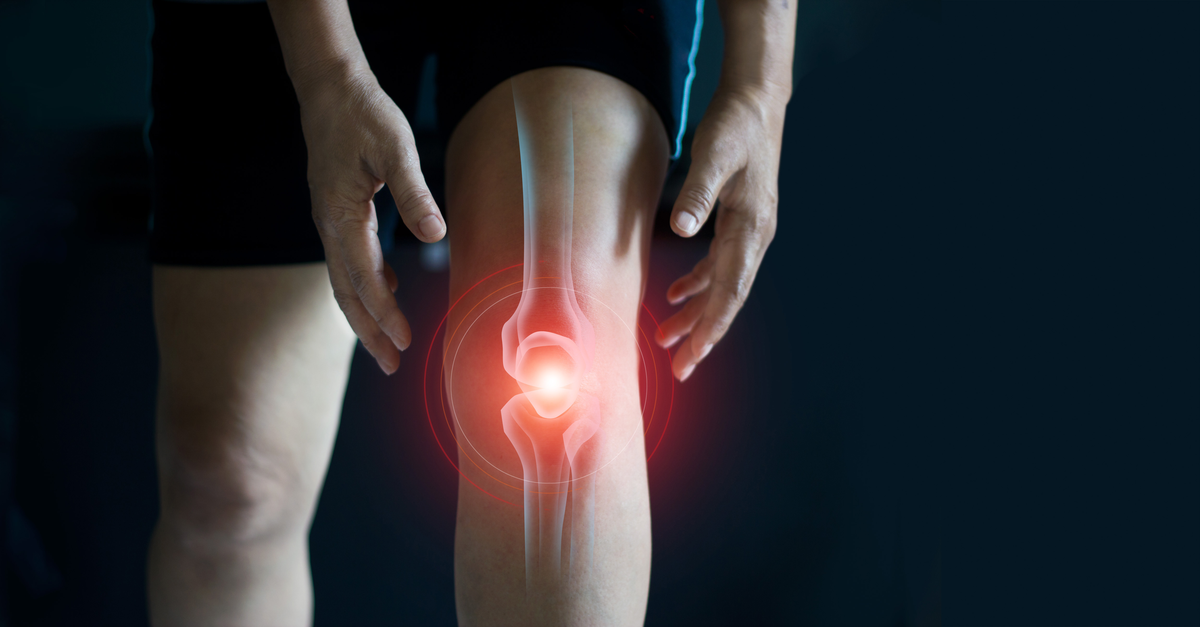 Knee Arthritis