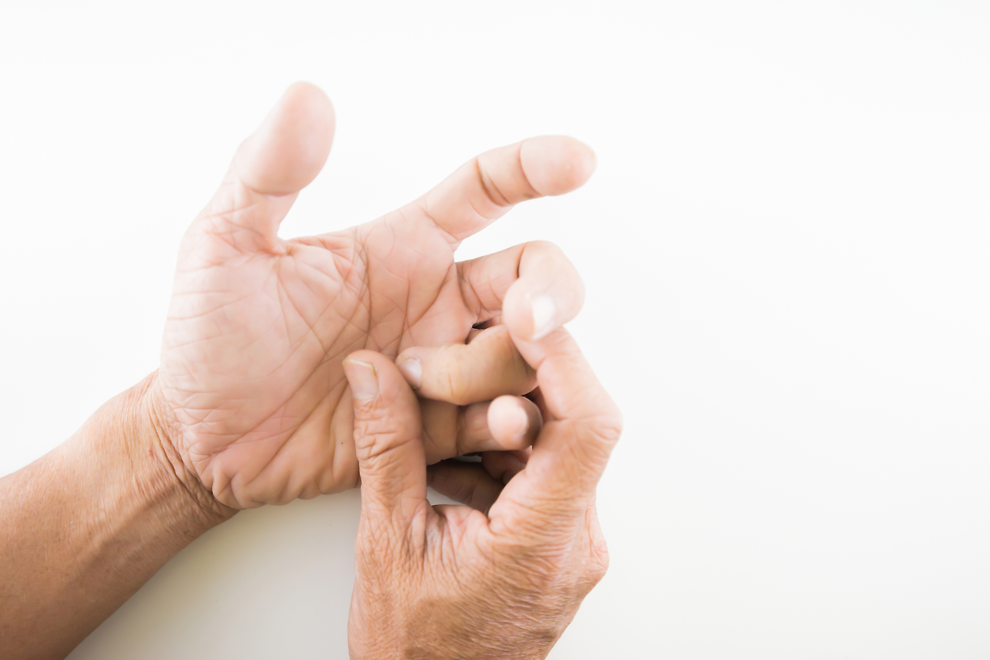 Trigger Finger or Trigger Thumb: Otherwise Known as Stenosing