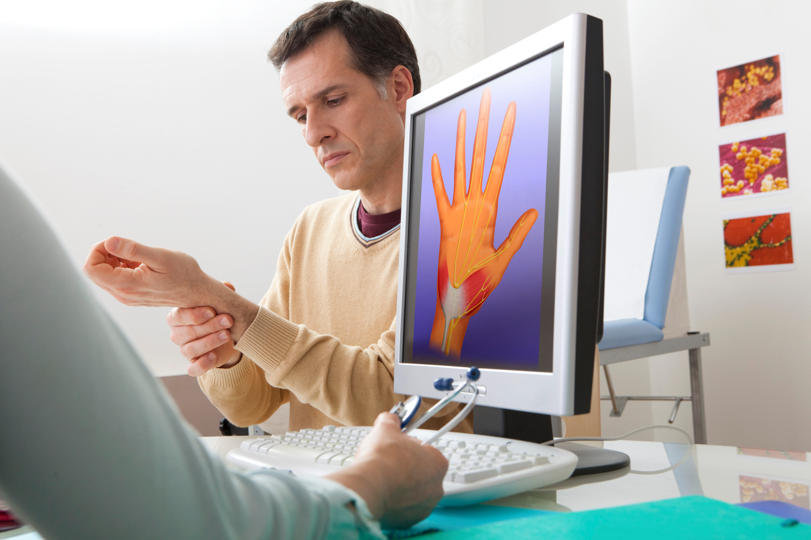 sign of carpal tunnel syndrome