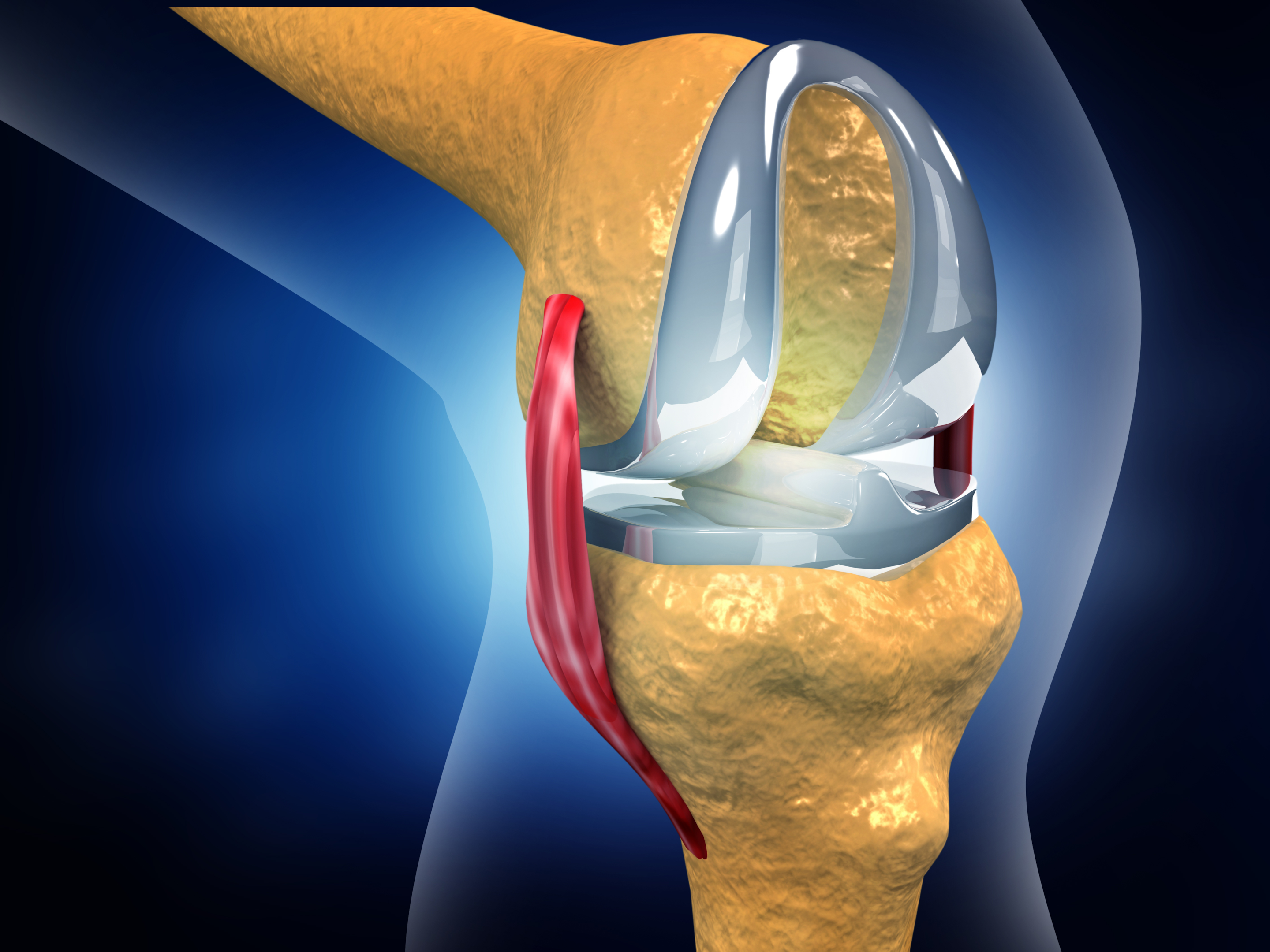 outpatient knee replacement surgery