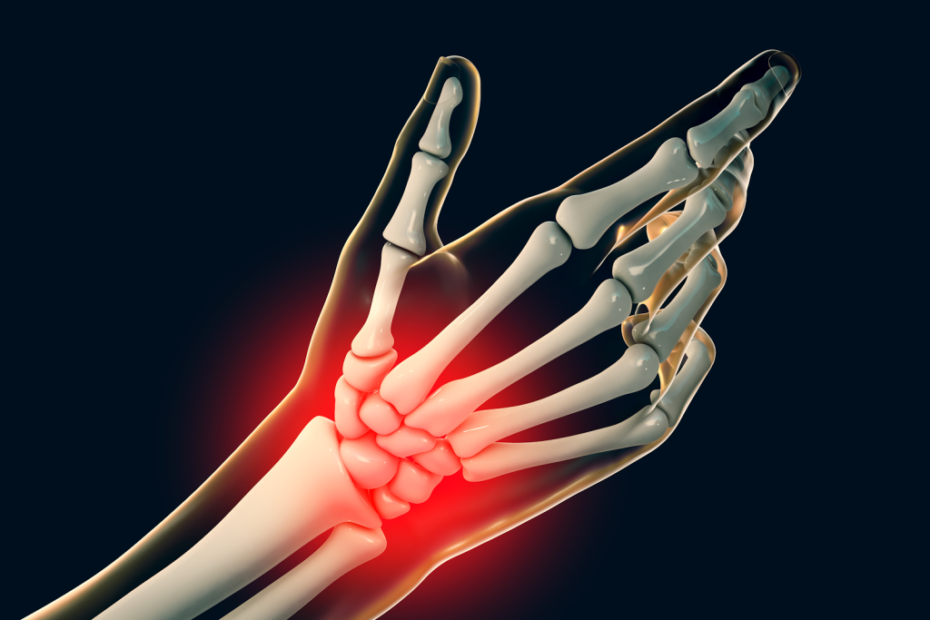 imaging key wrist ligaments