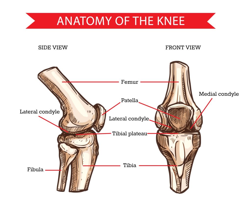 proximal tibia fracture
