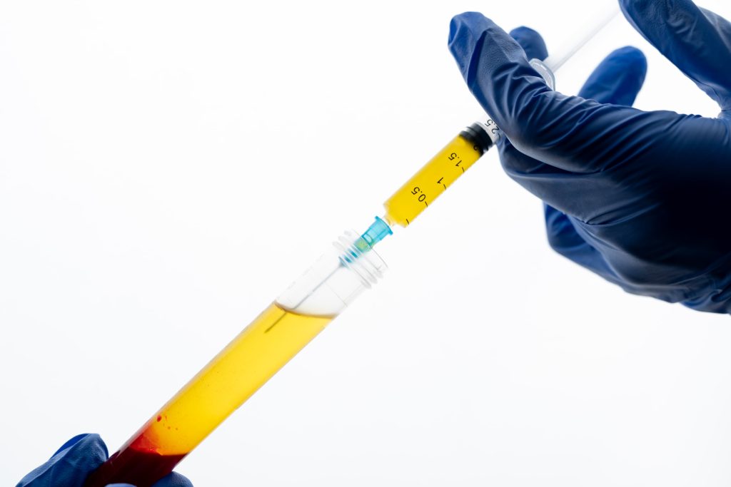 What is Platelet-Rich Plasma (PRP) Therapy