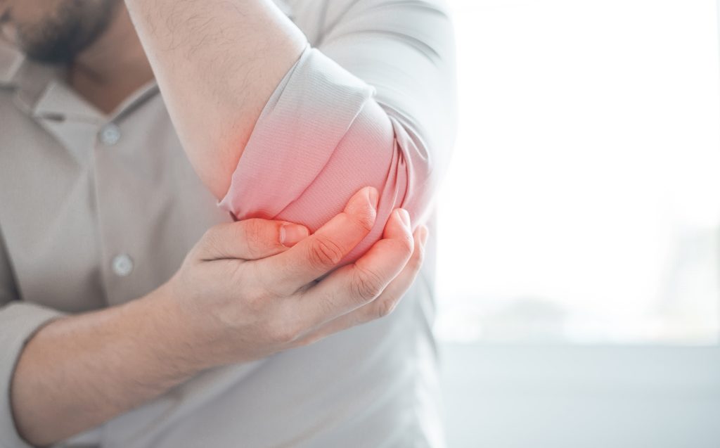 cubital tunnel syndrome